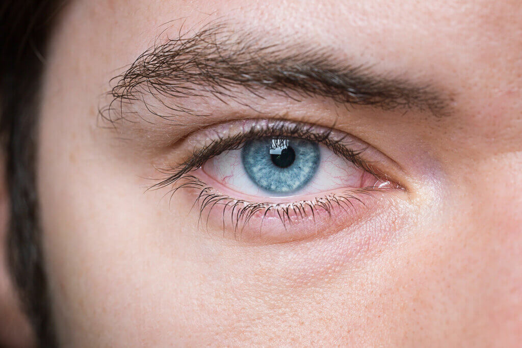 Topographie gesteuerte Lasik