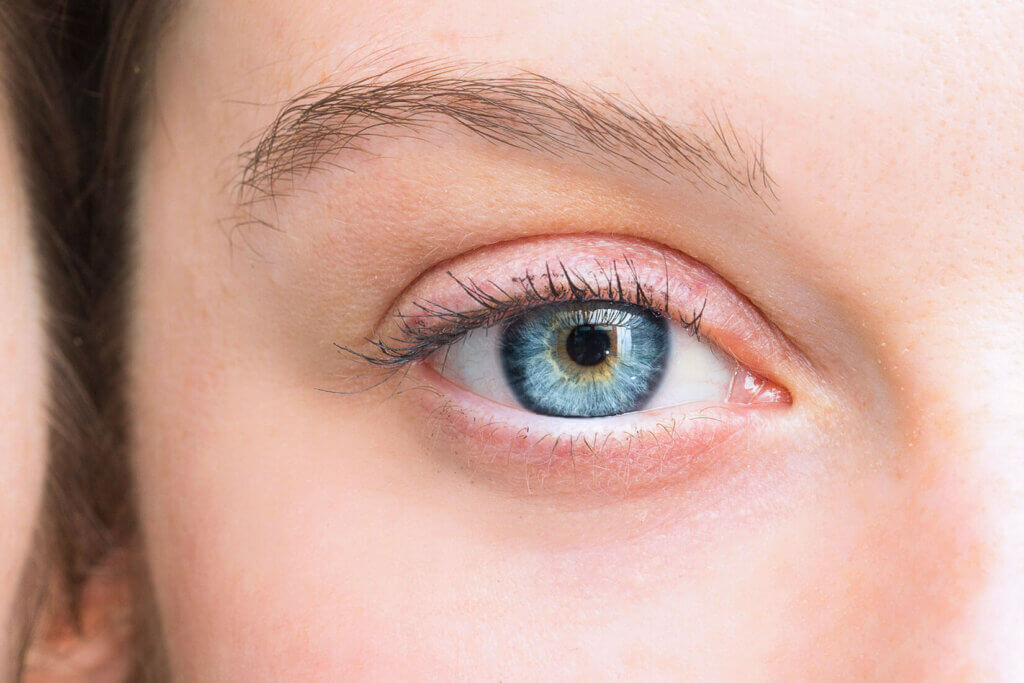 Clearlens Exchange (Linsenaustausch)