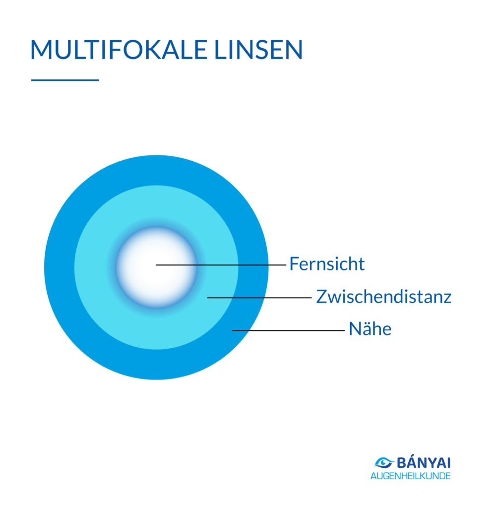 Multifokale Linsen