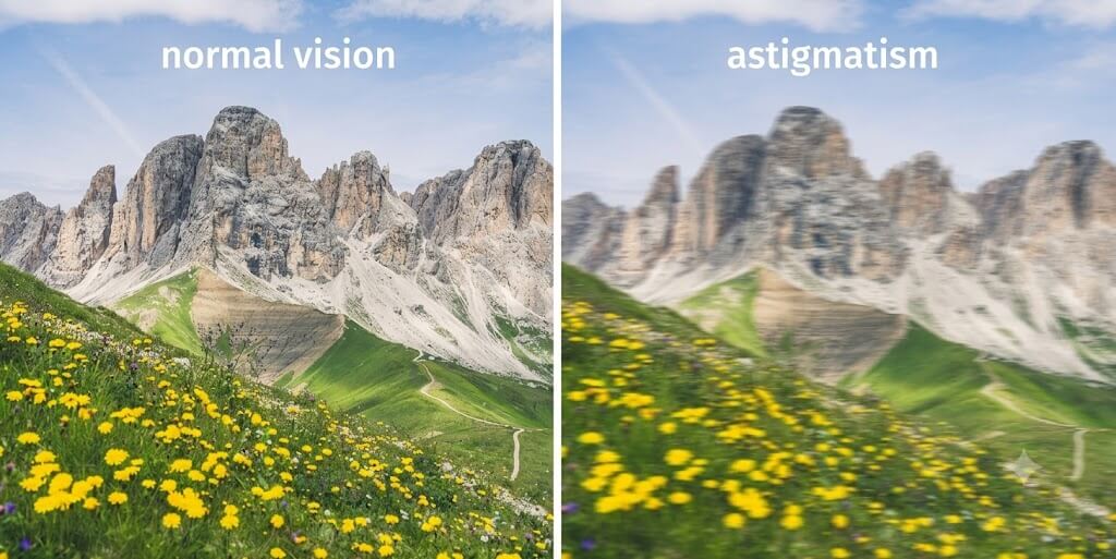 How does a corneal curvature actually occur?