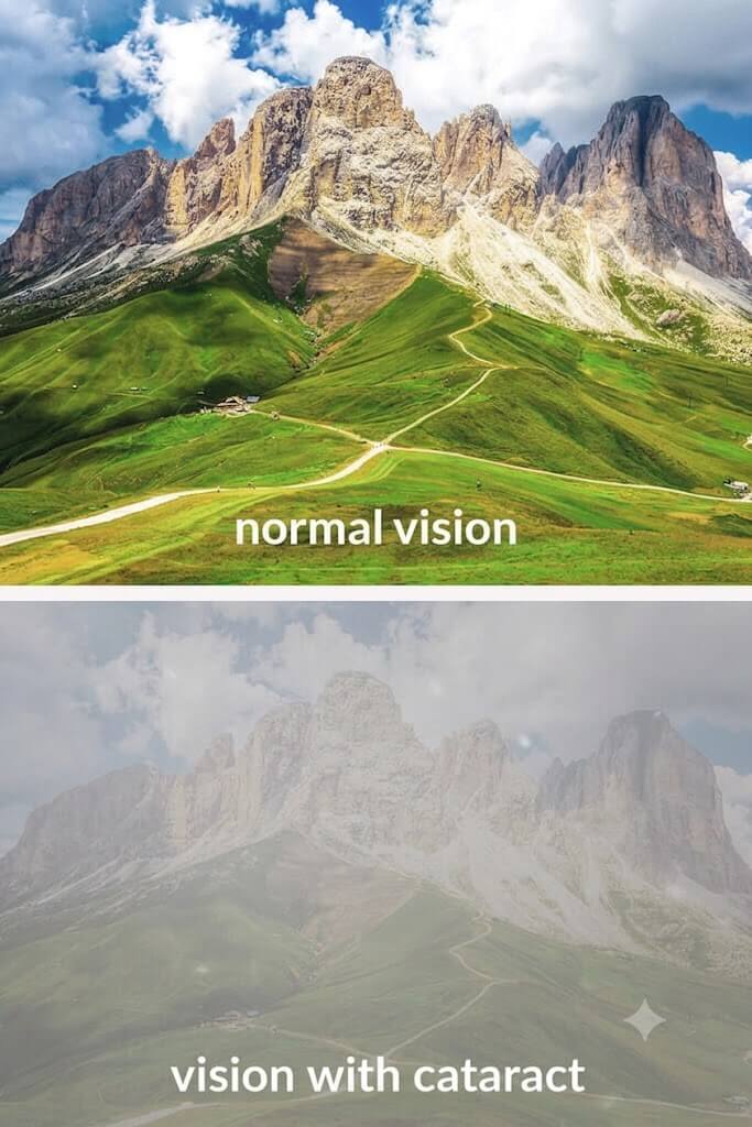 Which cataract symptoms occur?