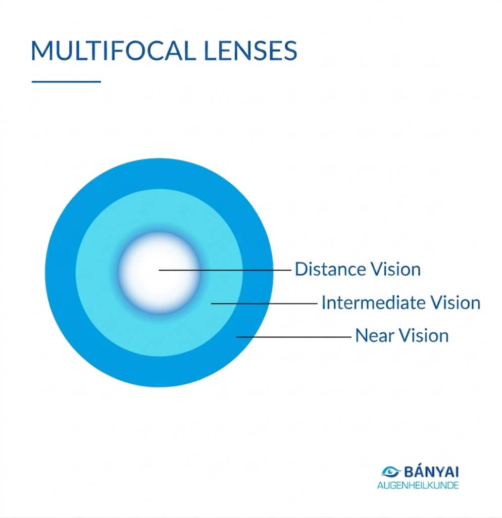 Multifocal Lenses