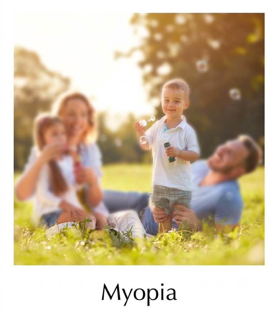 Comparing refractive errors: How does myopia develop? Causes and Symptoms - Banyai Ophthalmology