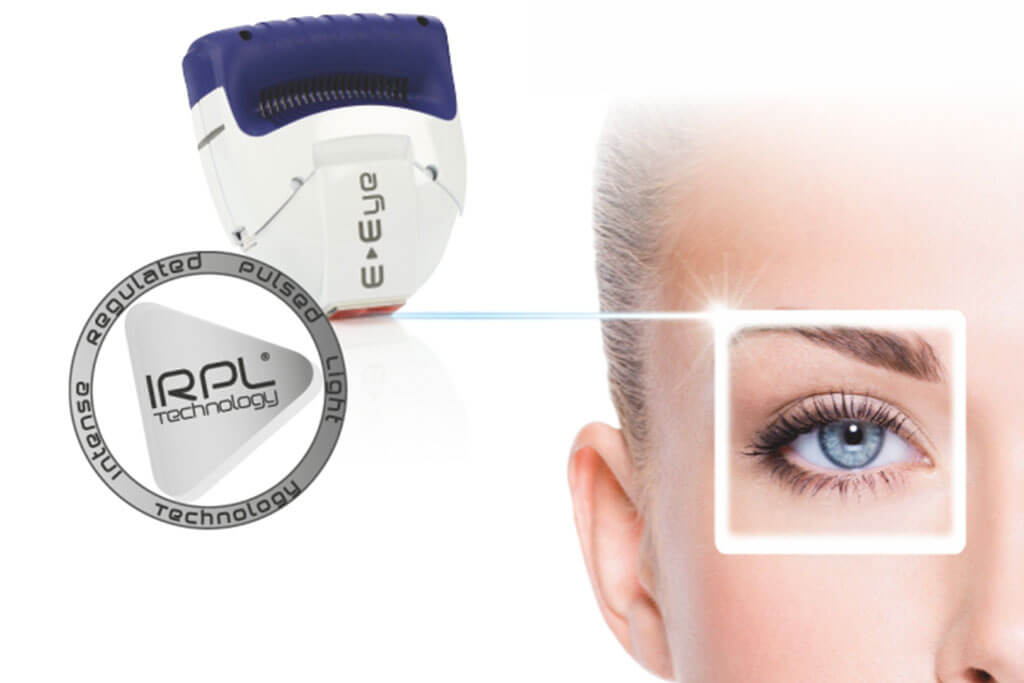 Sicca-Syndrom-Behandlung mit E-Eye