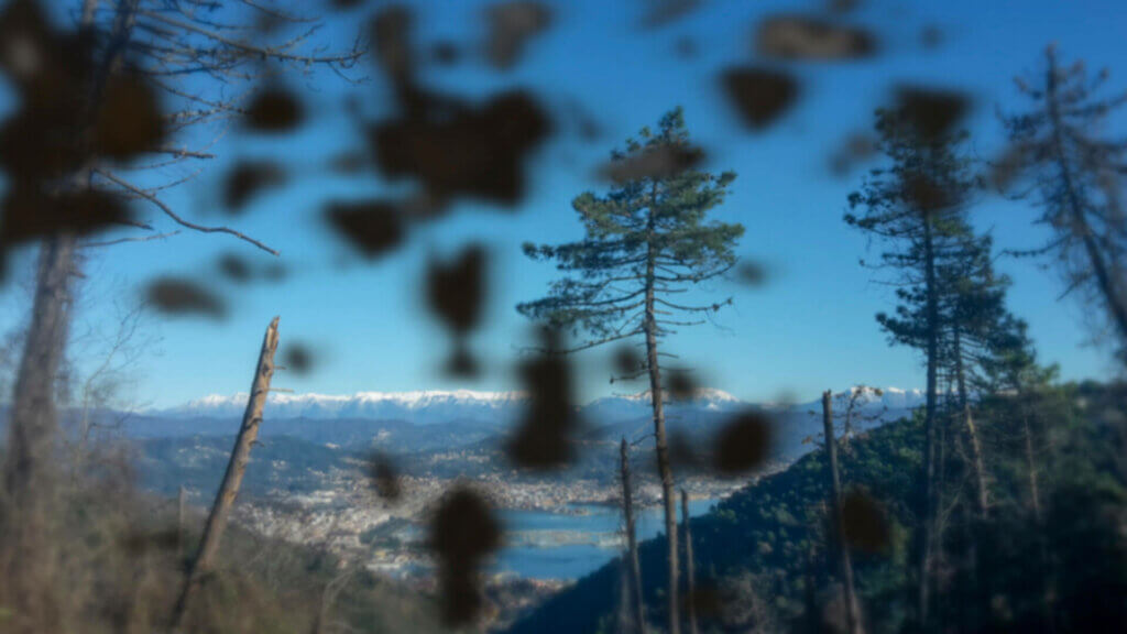 Bei der Netzhautablösung können schwarze Flecken das Sichtfeld stören