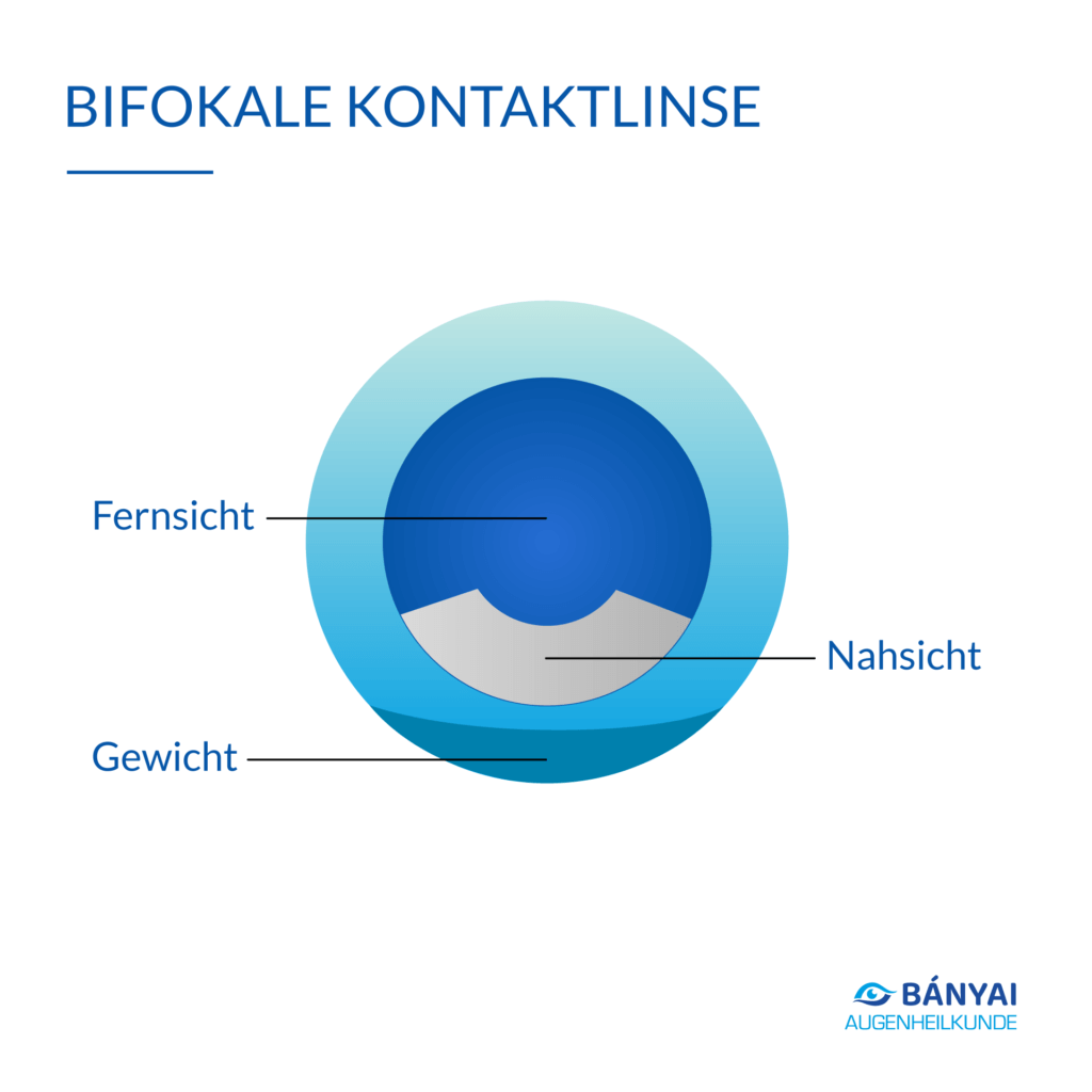 Kontaktlinsen & Tipps für beschwerdefreies Tragen