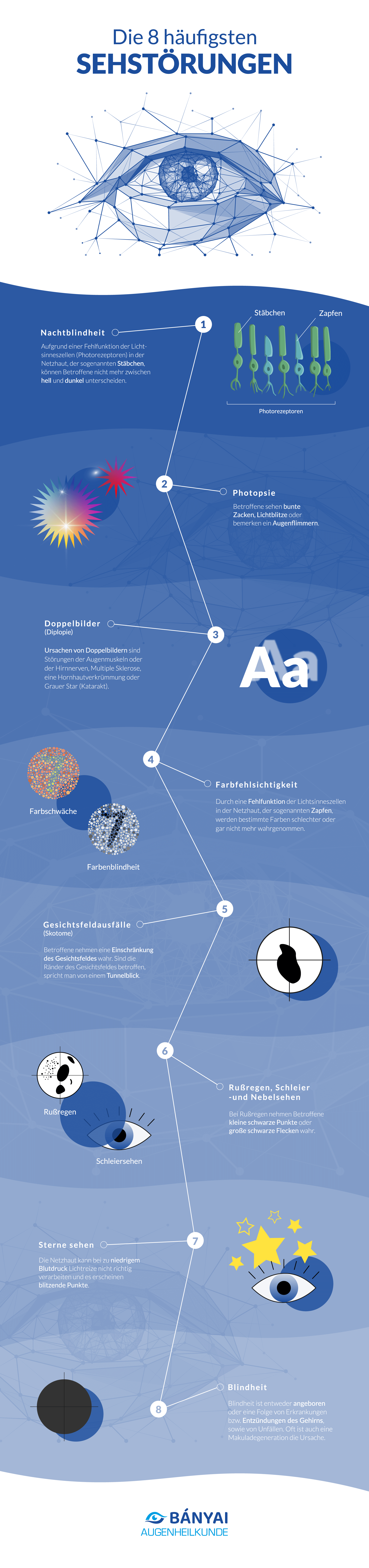 Die 8 häufigsten Sehstörungen