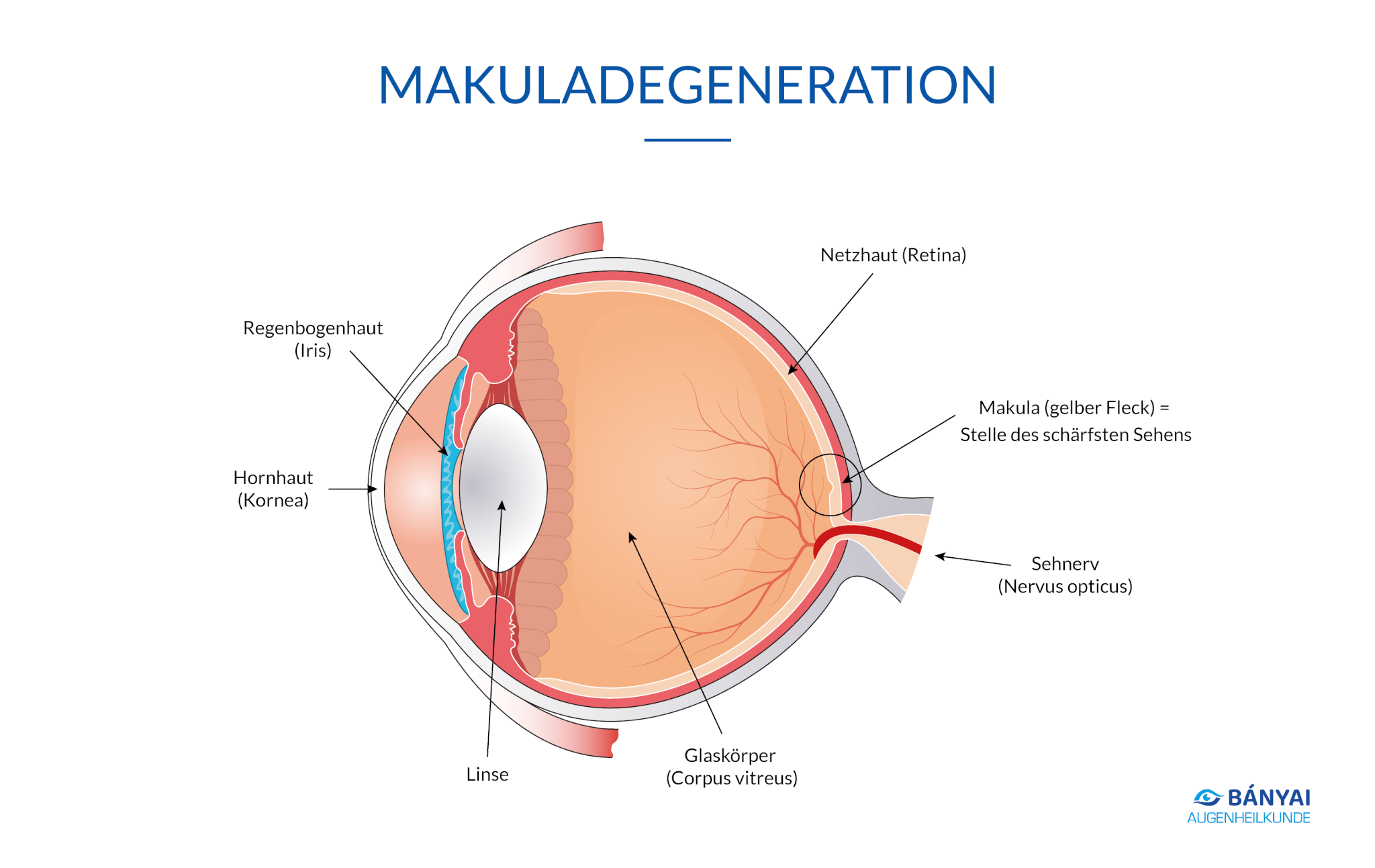 Augenerkrankungen: altersbedingte Makuladegeneration (AMD)